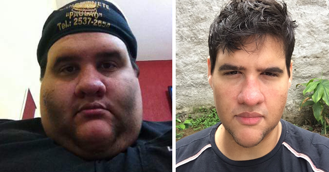 Antes e depois Gabriel Freitas